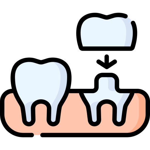 dental crown Illustration